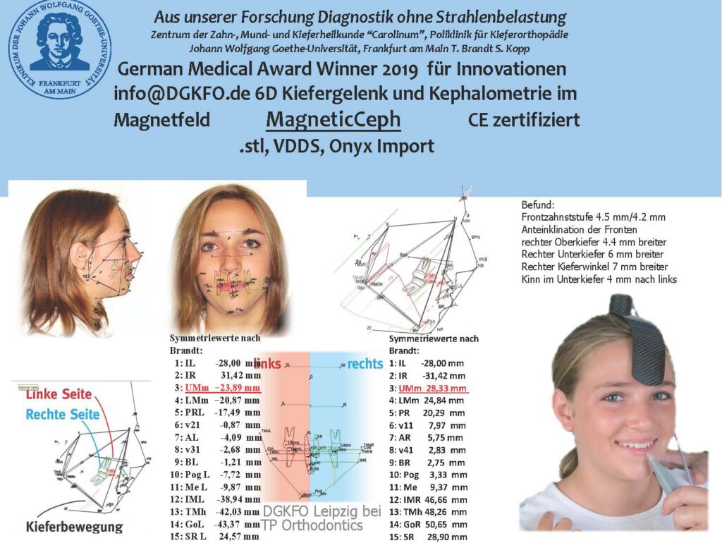 Vermessung der Anatomie des Kopfes mit der Ingration der .STL Daten aus Onyx Import, VDDS Schnittstellen