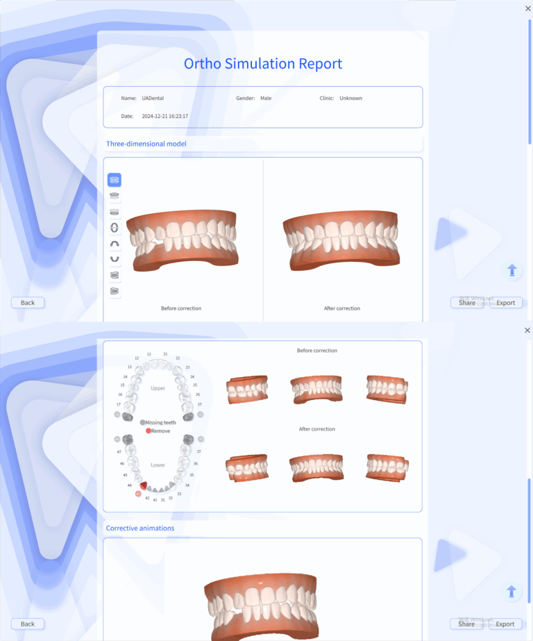 bILD ORTHO SIMULATION